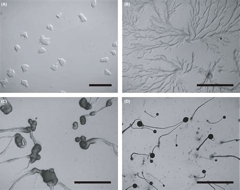  Dictyosteliumdiscoideum: Lovable Slug or Microscopic Mastermind?