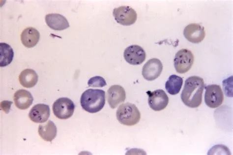  Babesia! Những Ký Sinh Trùng Mικroscoρic Gây Bệnh Cho Các Loài Động Khác