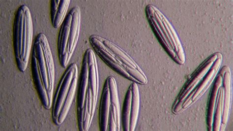  Urotrichia: A Microbial Marvel Exhibiting Extraordinary Ciliary Adaptations!